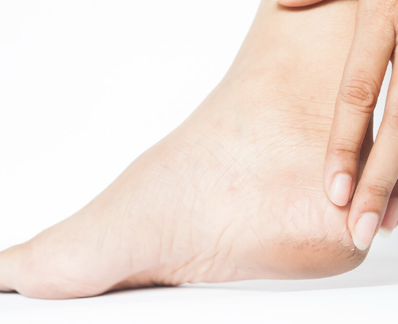 Calluses, Hard, Dry & Rough Skin