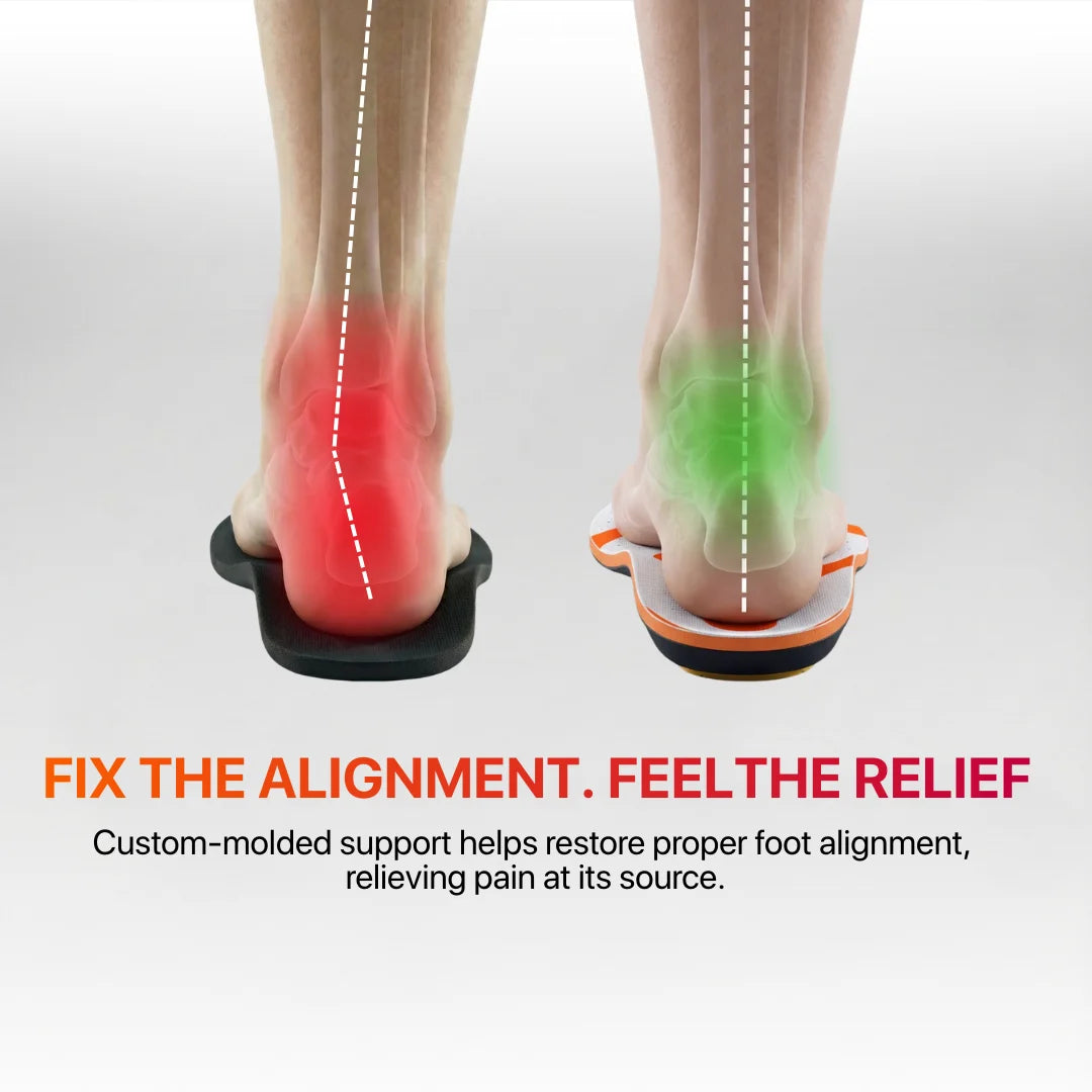 Foostep™ Heat-Molded Pain Relief Insoles