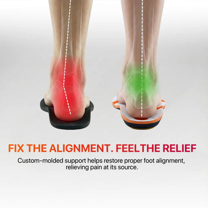 Foostep™ Heat-Molded Pain Relief Insoles